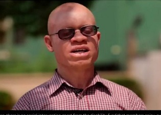Don’t kill us for rituals ahead of 2020 elections – Albinos ‘beg’ Ghanaian politicians