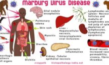The Marburg virus disease – should we be worried?