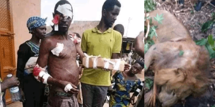 Samson of Kwande: Benue man kills lion with bare hand, lands in hospital