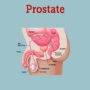 A diagram of a prostate